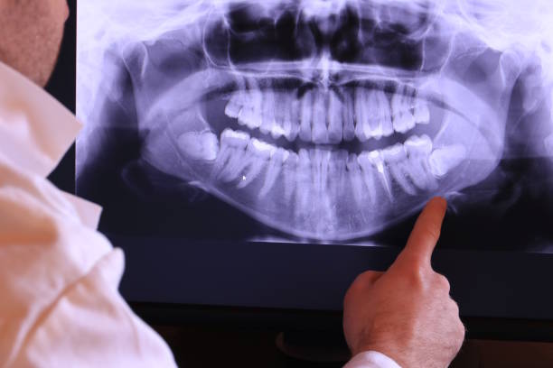Best Broken or Cracked Tooth Emergency Dentist in Loveland, CO